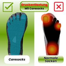 Lade das Bild in den Galerie-Viewer, Caresocks orthopädische Kompressionsstrümpfe - verhindert Krampfadern &amp; entlastet müde Füße